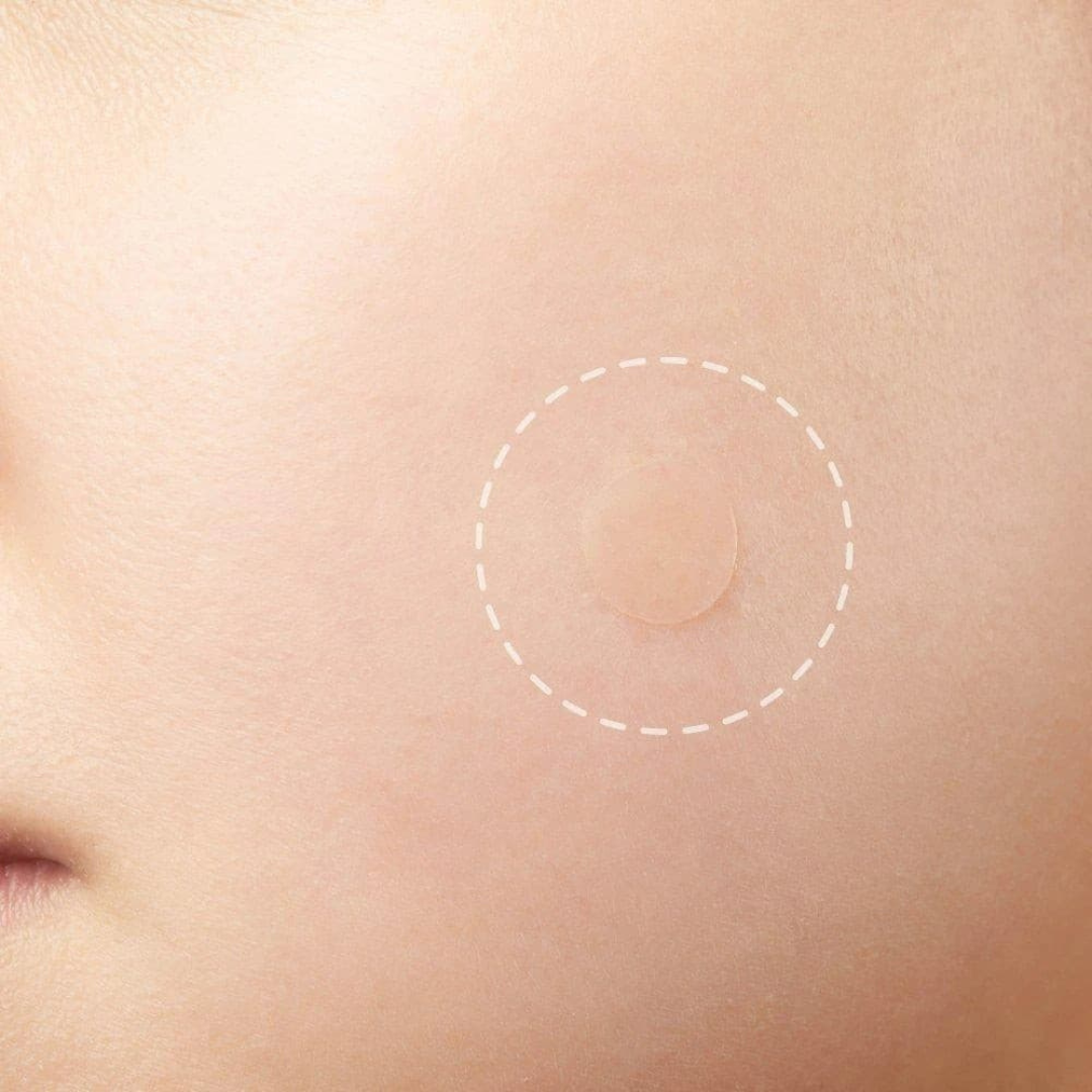 Acne Pimple Master Patch