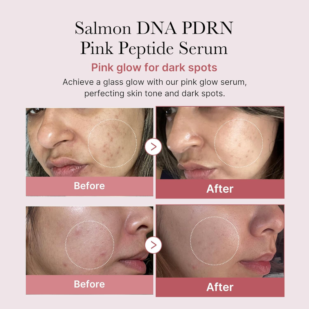 PDRN Pink One Day Serum