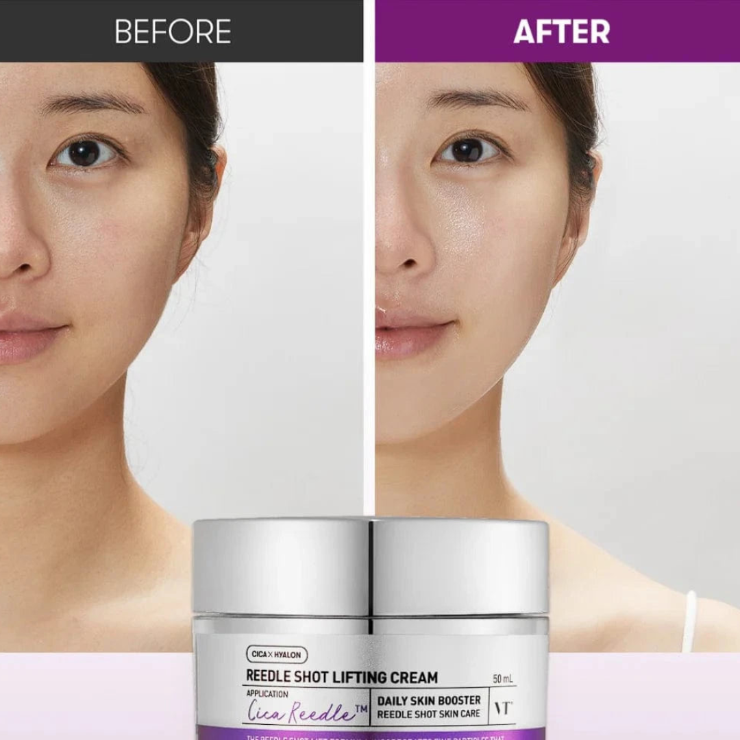 Reedle Shot Lifting Cream