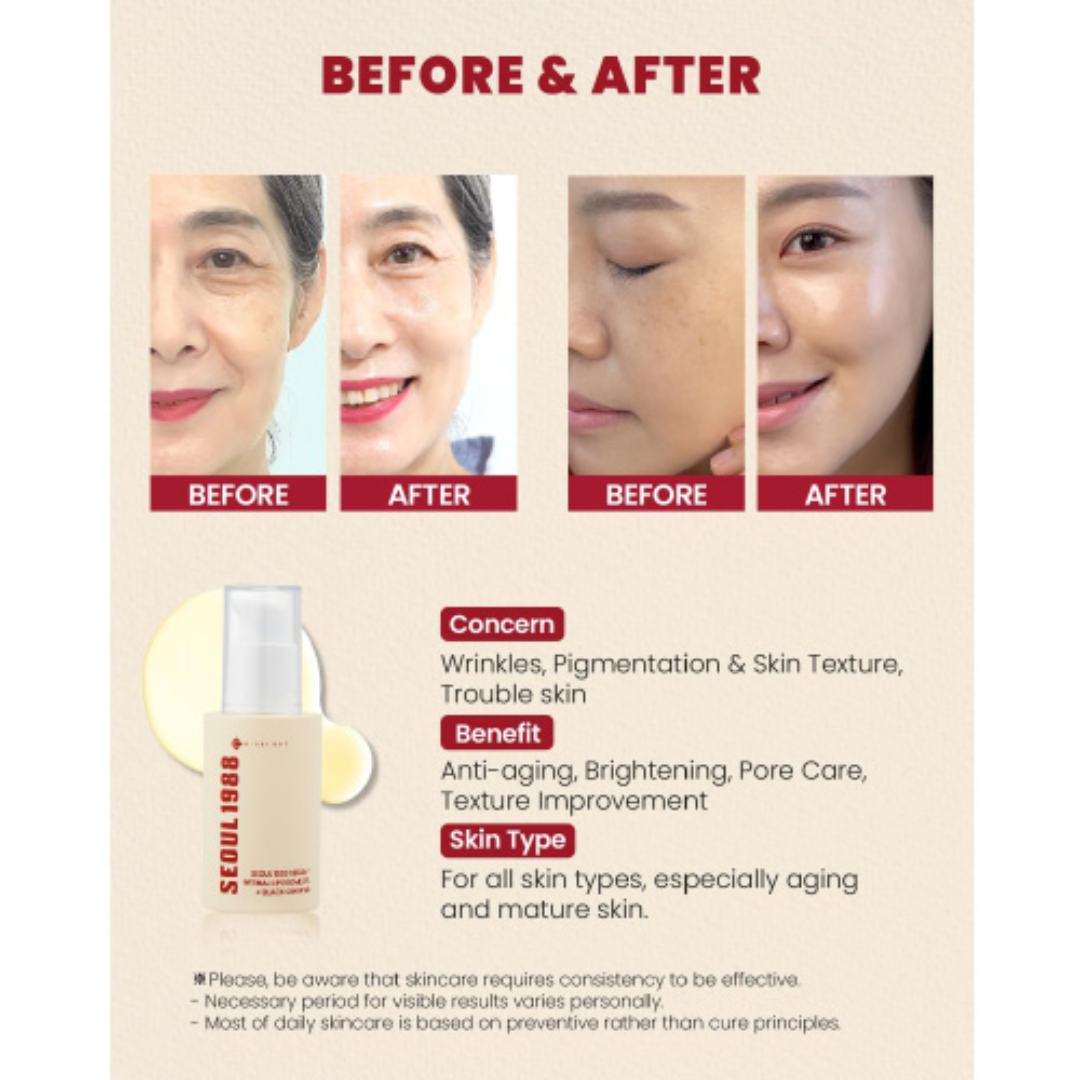 SEOUL 1988 Serum : Retinal Liposome 2% + Black Ginseng