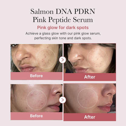 PDRN Pink One Day Serum