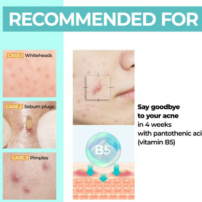 No.1 Pantothenic B5 Active Soothing Serum