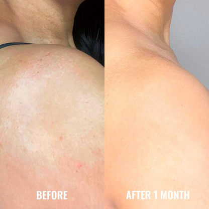 Discoloration Correcting Body Treatment